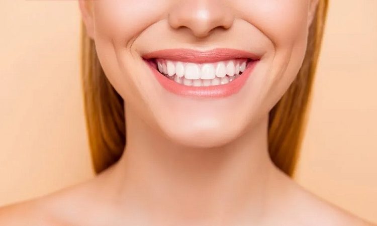 روش های افزایش طول عمر لمینت دندان | بهترین دندانپزشک زیبایی اصفهان