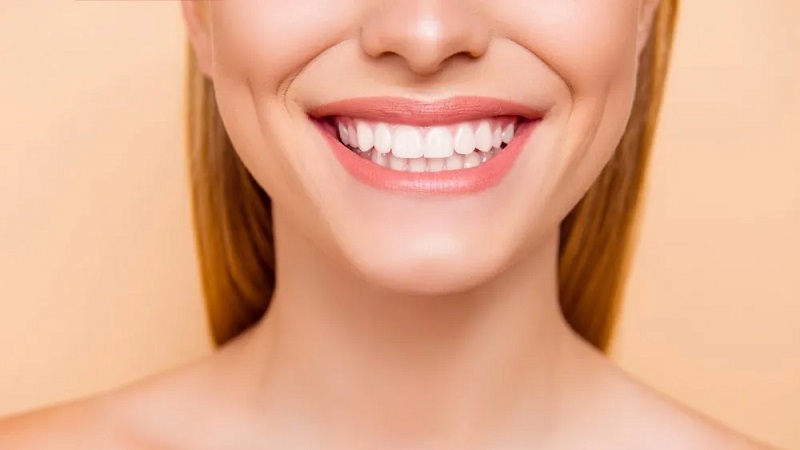 روش های افزایش طول عمر لمینت دندان | بهترین دندانپزشک زیبایی اصفهان