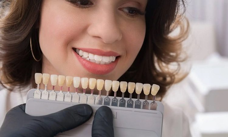 ما هي مميزات تركيب العدسات اللاصقة المصفحة؟ | افضل دكتور اسنان في اصفهان