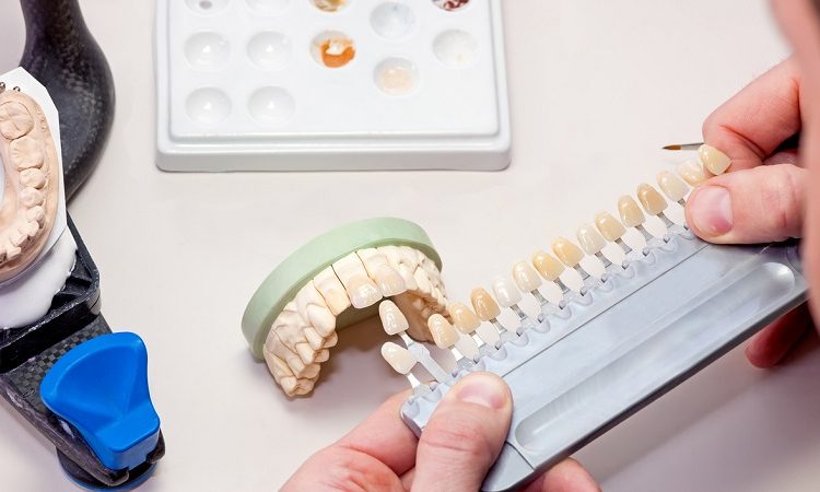 روش های مختلف ساخت دندان مصنوعی | بهترین دندانپزشک زیبایی اصفهان