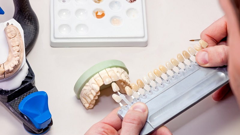 روش های مختلف ساخت دندان مصنوعی | بهترین دندانپزشک زیبایی اصفهان