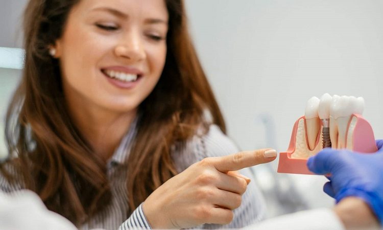 أسباب وأعراض فشل زراعة الأسنان | افضل دكتور اسنان تجميلي في اصفهان
