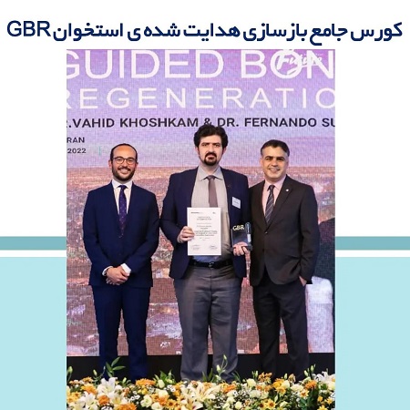 مدرک بازسازی هدایت شده ی استخوان (GBR) | بهترین ایمپلنت اصفهان