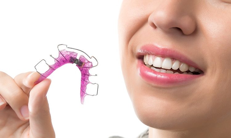 مزایا و معایب انواع مختلف ارتودنسی متحرک دندان | بهترین جراح لثه اصفهان