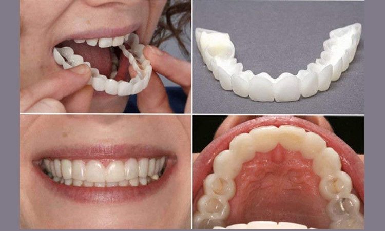 Advantages and disadvantages of removable dental laminate | The best implant in Isfahan