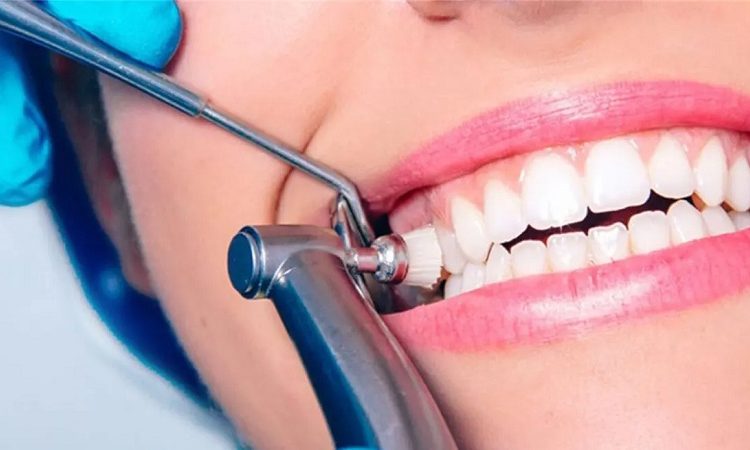 Tips for before scaling and tooth brushing | The best cosmetic dentist in Isfahan