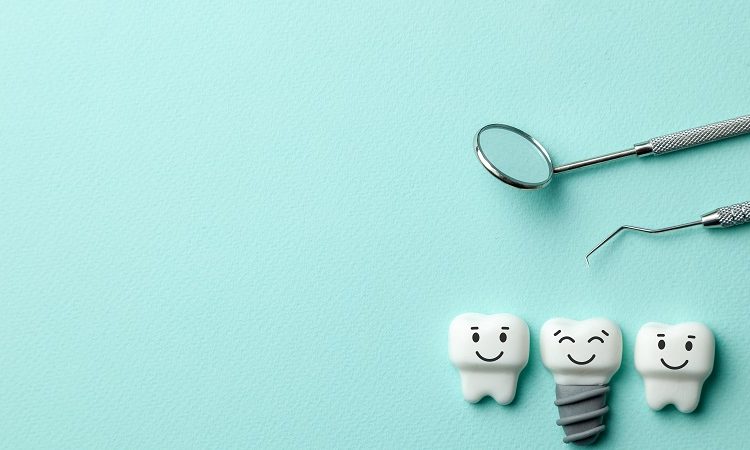 محدودیت های کاشت ایمپلنت دندان | بهترین دندانپزشک اصفهان