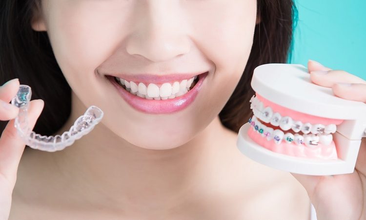 Disadvantages and advantages of invisible orthodontics | The best implant in Isfahan