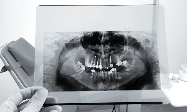 Utilisations des photos d'OPG | Le meilleur dentiste d'Ispahan