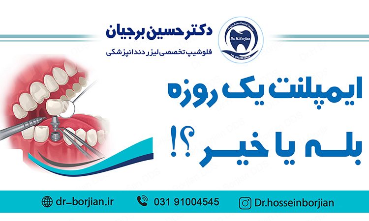 ایمپلنت یک روزه بلــه یا خیــر|بهترین دندانپزشک اصفهان