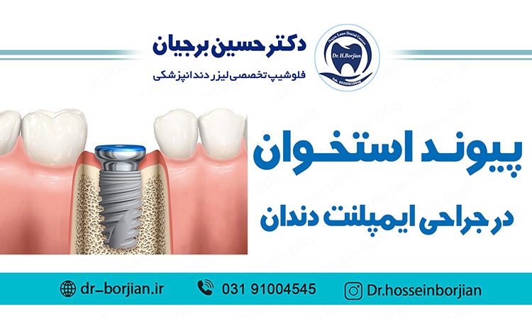 پیوند استخوان در جراحی ایمپلنت دندان|بهترین دندانپزشک اصفهان