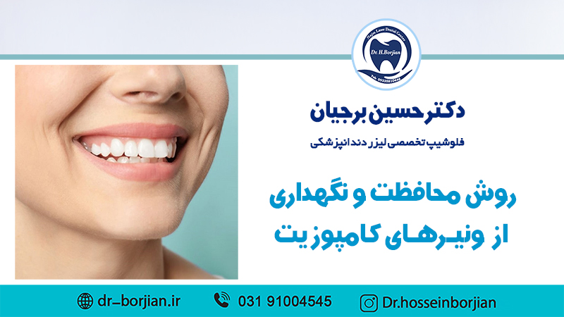 روش محافظت و نگهداری از ونیرهای کامپوزیت|بهترین دندانپزشک اصفهان