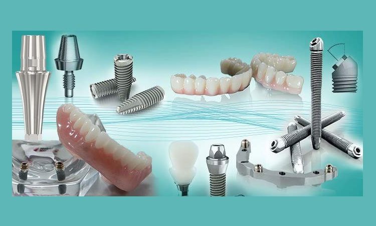 آشنایی با انواع پروتز بر پایه ایمپلنت | بهترین دندانپزشک زیبایی اصفهان