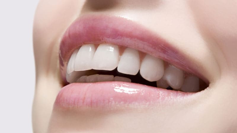 بررسی لمینت دندان بدون تراش دندان | بهترین دندانپزشک اصفهان