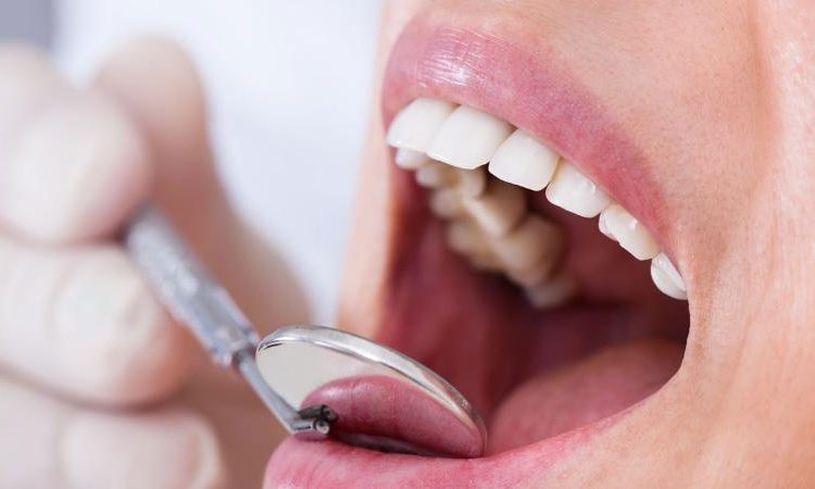 بررسی کف بندی دندان | بهترین جراح لثه اصفهان