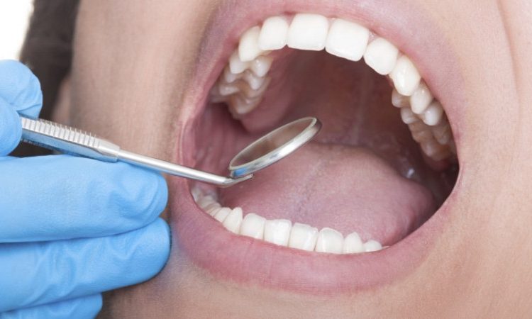 تغییر رنگ دندان بعد از عصب کشی | بهترین جراح لثه اصفهان