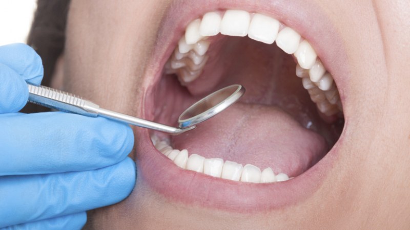 تغییر رنگ دندان بعد از عصب کشی | بهترین جراح لثه اصفهان