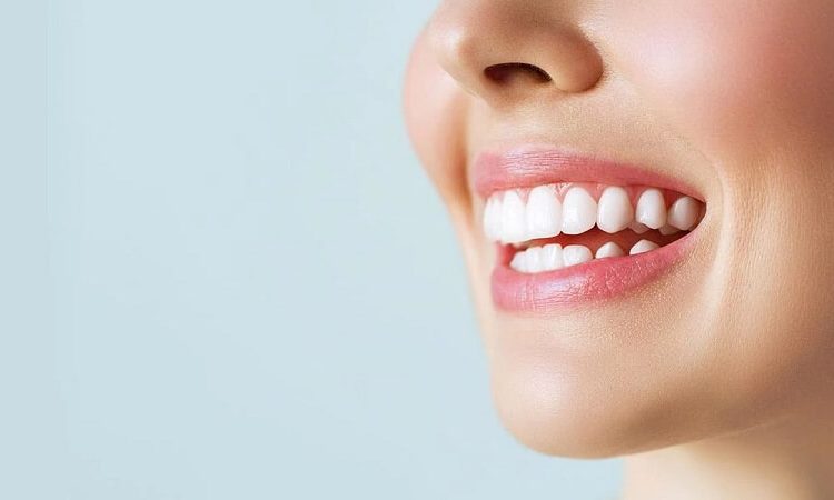 علل بلیچینگ بعد از ارتودنسی | بهترین دندانپزشک زیبایی اصفهان