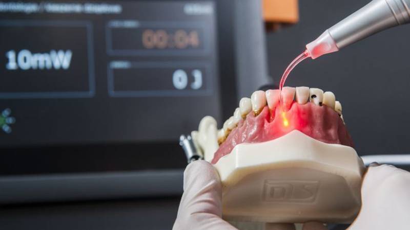 مزایای استفاده از لیزر اپیک ایکس در دندانپزشکی | بهترین دندانپزشک اصفهان