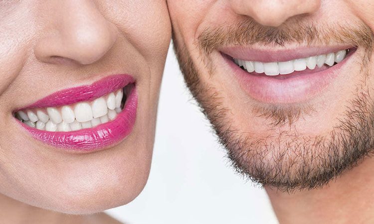 نحوه انجام لمینت دندان | بهترین جراح لثه اصفهان