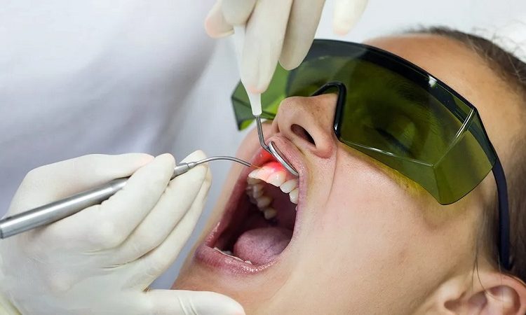 Erbium laser applications in dentistry | The best cosmetic dentist in Isfahan