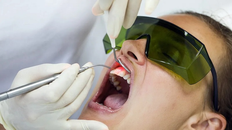 کاربردهای لیزر اربیوم در دندانپزشکی | بهترین دندانپزشک زیبایی اصفهان