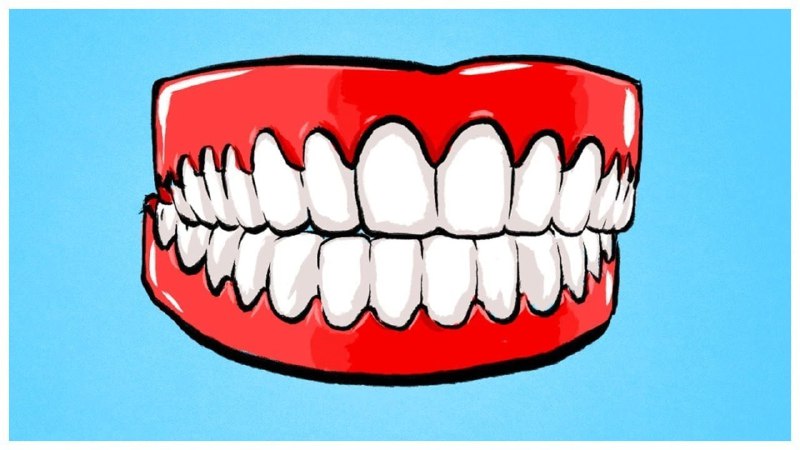 تاثیر مشکلات بر دندان‌های جلوی فک بالا | بهترین جراح لثه اصفهان