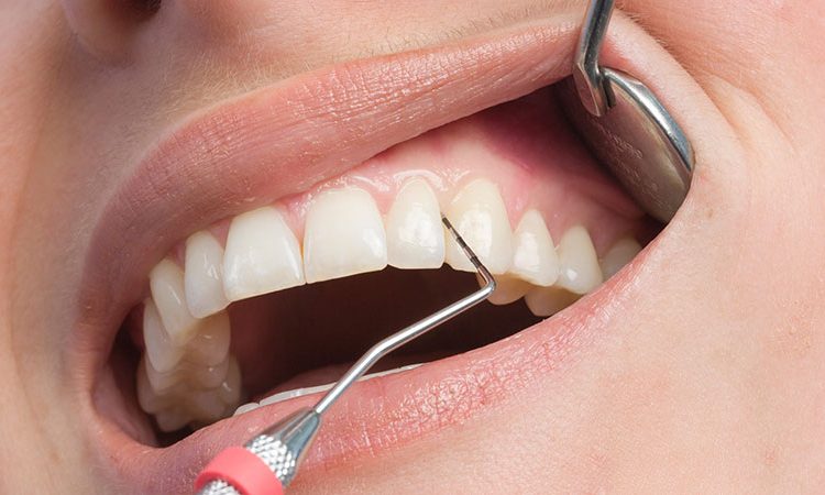 روش های درمان بیماری پریودنتال | بهترین دندانپزشک زیبایی اصفهان