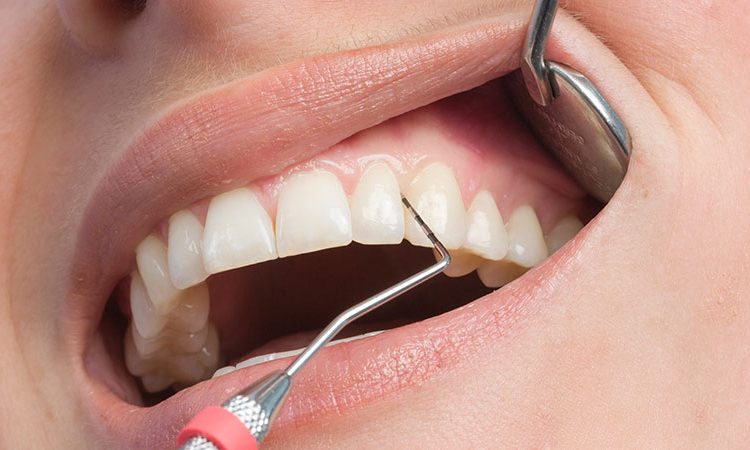 Periodontal disease treatment methods | The best cosmetic dentist in Isfahan