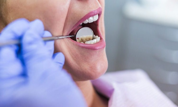 روش های درمان عفونت ایمپلنت دندان | بهترین دندانپزشک زیبایی اصفهان