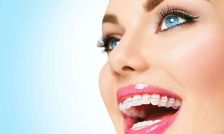 Procedures of dental orthodontic treatment | The best gum surgeon in Isfahan