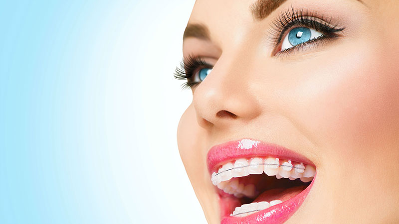 مراحل انجام درمان ارتودنسی دندان | بهترین جراح لثه اصفهان