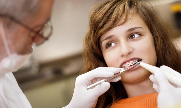 Avantages de l'orthodontie préventive | Le meilleur dentiste d'Ispahan