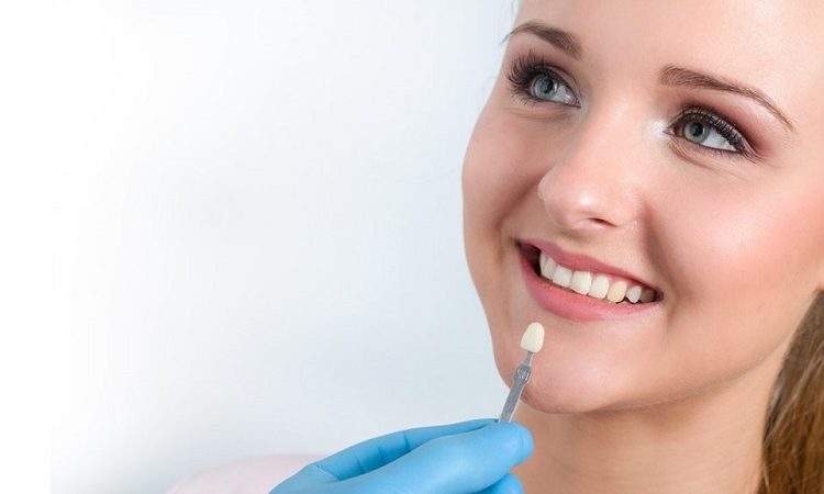 Familiarité avec les facettes dentaires en zircone | Le meilleur chirurgien des gencives à Ispahan