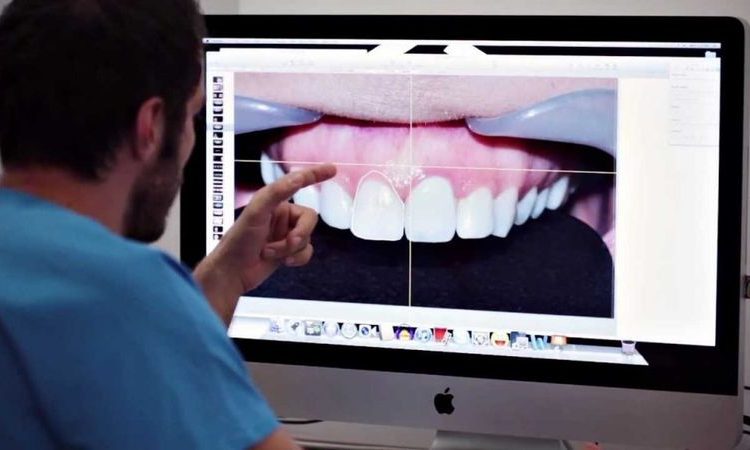 صب الأسنان الرقمي وفوائدها | افضل دكتور اسنان تجميلي في اصفهان