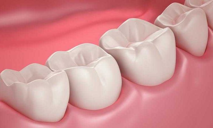 Answers to questions about dental fillings | The best implant in Isfahan
