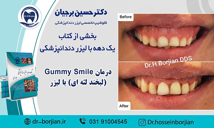 بخشی از کتاب یک دهه با لیزر دندانپزشکی | بهترین دندانپزشک اصفهان