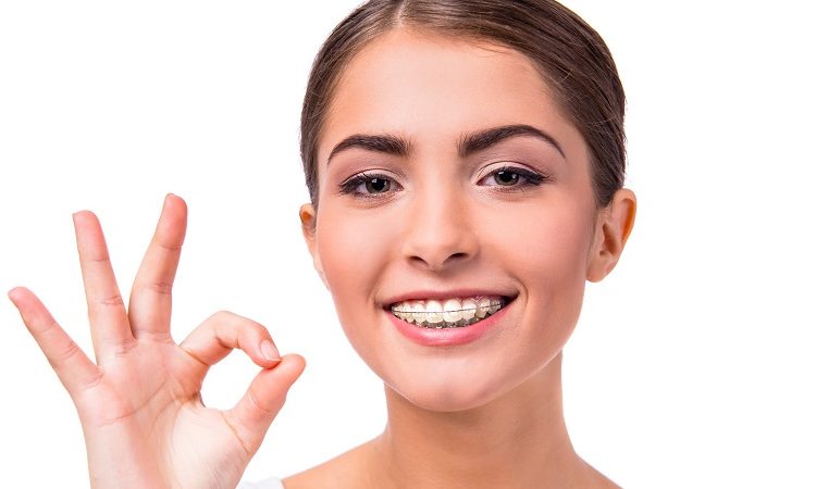 دلایل برگشت نتایج ارتودنسی دندان | بهترین جراح لثه اصفهان