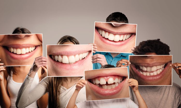 Smile design correction methods | The best dentist in Isfahan
