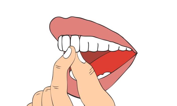 Causes des dents permanentes lâches chez les enfants et les adultes | Le meilleur chirurgien des gencives à Ispahan