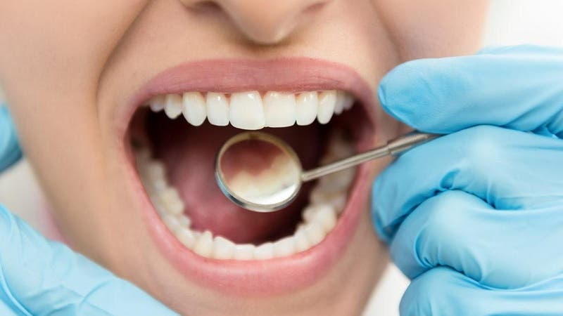علل پوسیدگی دندان | بهترین جراح لثه اصفهان