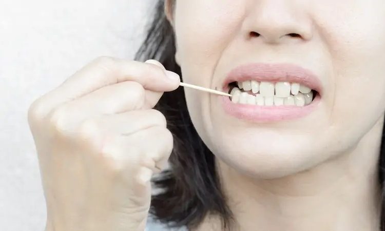 Investigating the causes and factors of teeth darkening | The best gum surgeon in Isfahan