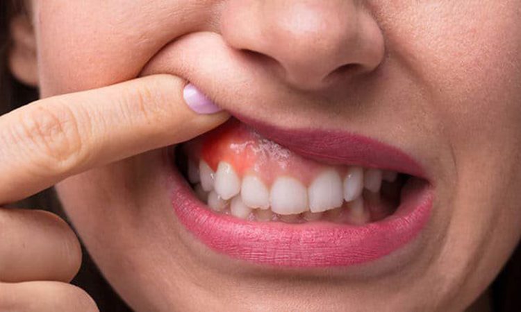 خطرات درمان نکردن عفونت دندان | بهترین دندانپزشک اصفهان