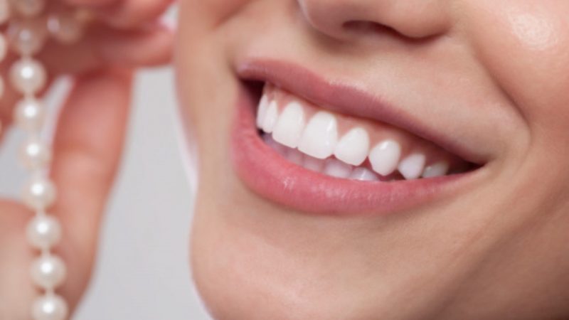 باندینگ دندان و انواع آن | بهترین جراح لثه اصفهان