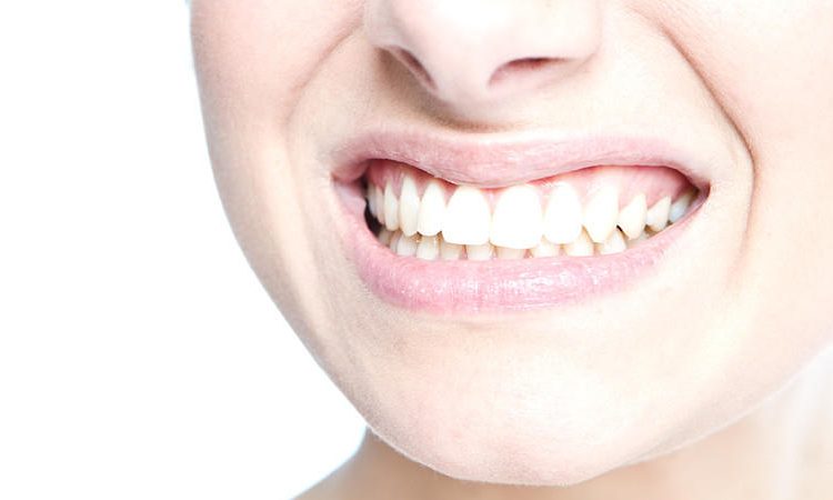 عوامل ایجاد لکه‌های خارجی و زرد شدن دندان‌ها | بهترین دندانپزشک اصفهان
