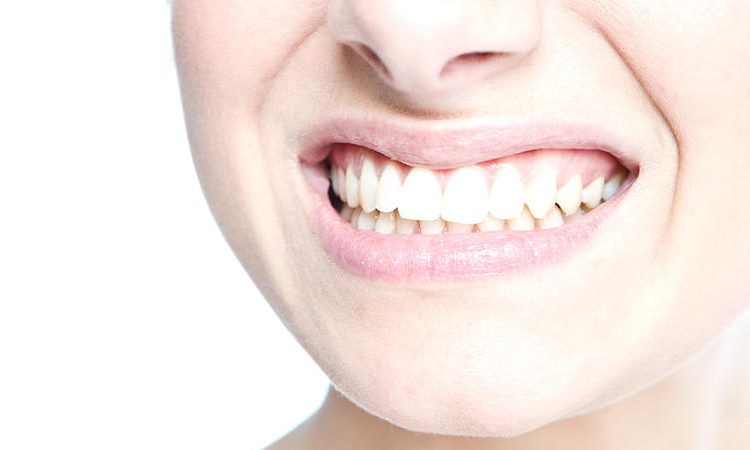 Causes of external stains and yellowing of teeth | The best dentist in Isfahan