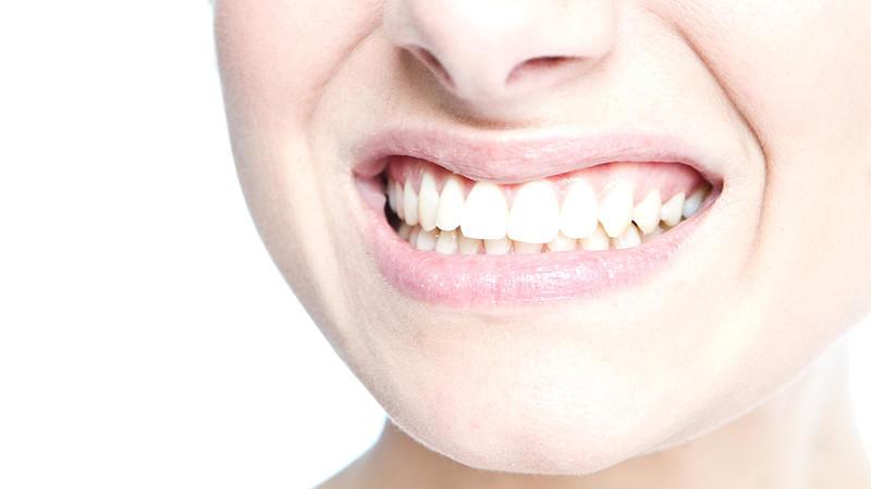 عوامل ایجاد لکه‌های خارجی و زرد شدن دندان‌ها | بهترین دندانپزشک اصفهان