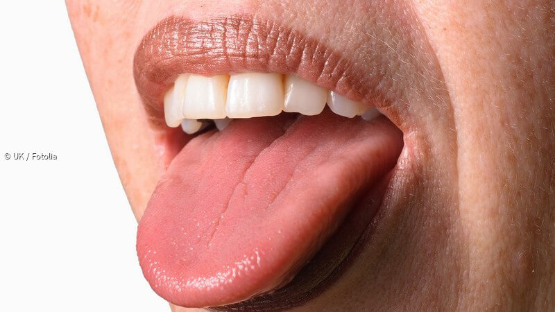 Causes des taches rouges dans la bouche | Le meilleur dentiste d ...