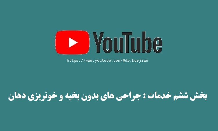 جراحی های بدون بخیه و خونریزی دهان | بهترین جراح لثه اصفهان