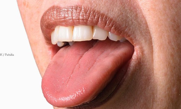 تشخيص وعلاج متلازمة الفم الحارق | افضل دكتور اسنان تجميلي في اصفهان
